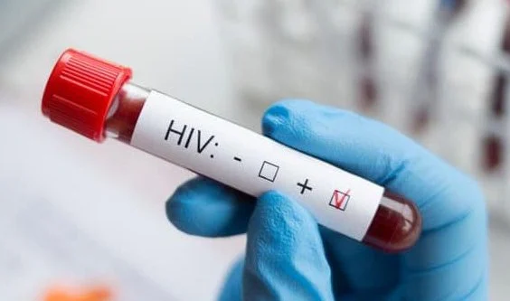 HIV’i eşinden saklayan adama hapis istemi